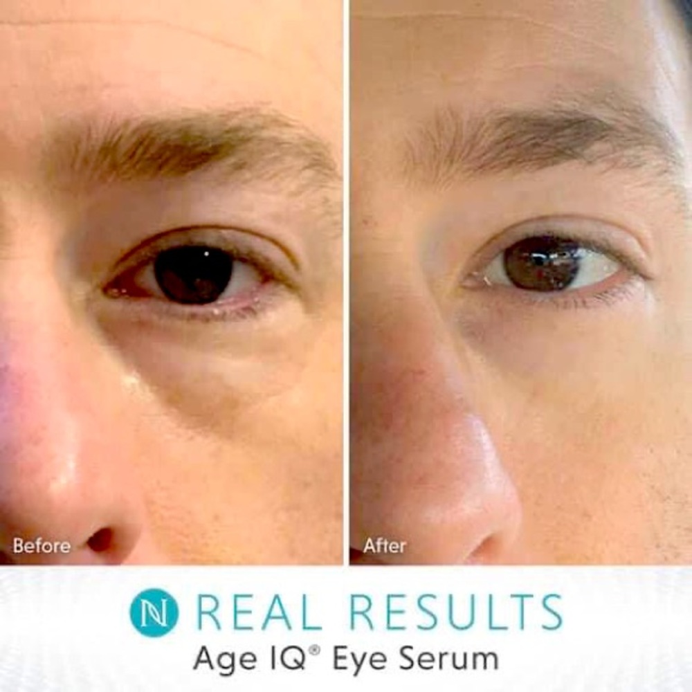 Neora Age IQ Eye Serum